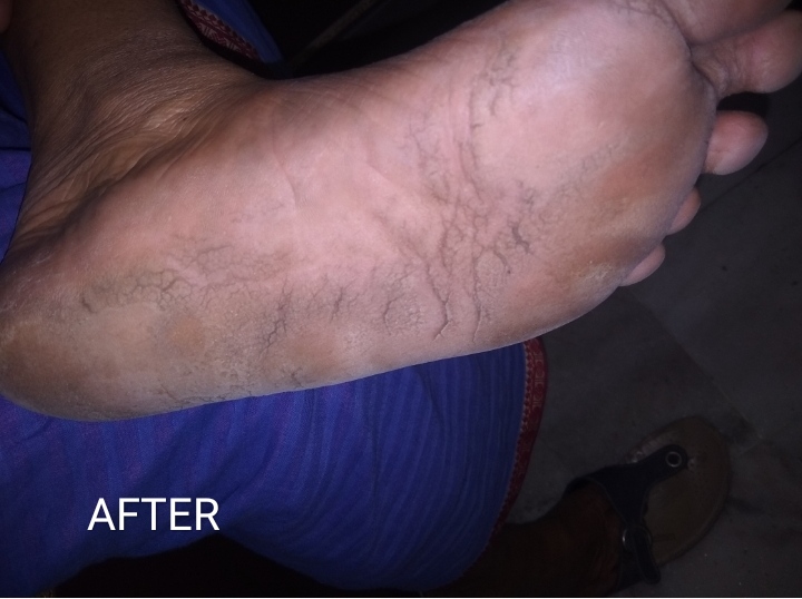After - Case 1