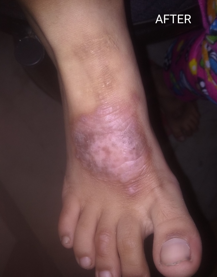 After - Case 2