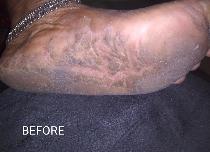 Before - Case 1