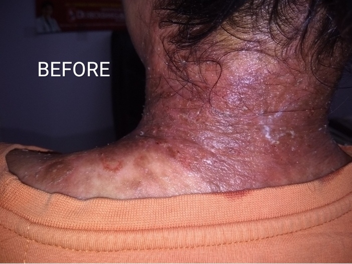 Before - Case 2
