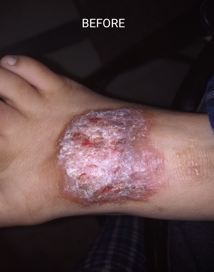 Before - Case 2